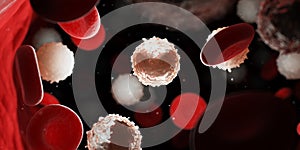 Too many white blood cells due to leukemia