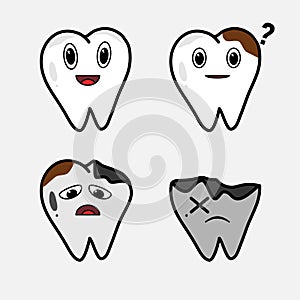 Stages of caries