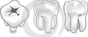 Tooth in 3 views