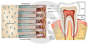 Tooth Anatomy. Cross-section of dentin. Dentinal tubules. Anatomy and Histology. Dentinal tubules photo
