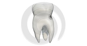 Tooth with caries, 3d animation. 3D rendering