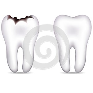 Tooth with caries and healthy tooth