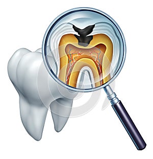 Tooth Cavity Close Up photo