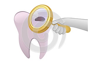 Tooth cavity photo