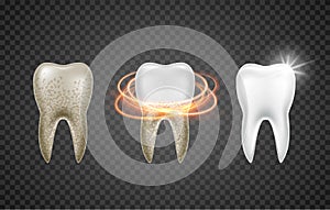 Tooth clean 3d health. Dental realistic dirty whitening. Dentist teeth hygiene medicine template