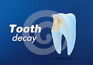 Tooth decay. Bad tooth. Dental care background. Unhealthy teeth. Stomatology care for teeth. Vector illustration photo