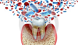 Tooth Decay Blood Bacteria