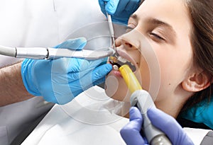 Zub úpadek v ústní hygiena 