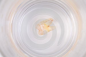 Tooth decay in a glass of water