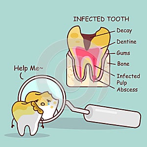 Tooth decay with health problem photo