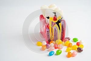 Tooth decay model with colorful candy sweet food on white background with copy space