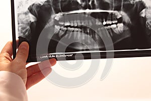 Tooth dental dentist radiograpy anatomy
