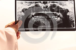 Tooth dental dentist radiograpy anatomy