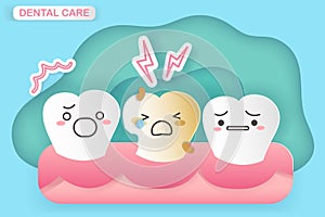 Tooth with dentin decay