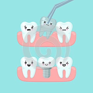 Tooth extraction and implantation stomatology concept, cute colorful teeth implant vector illustration