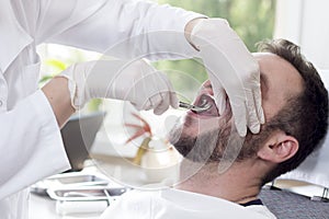 Tooth extraction in a white man. The doctor`s hands hold the forceps and catch the tooth.