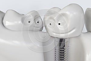 Tooth human cartoon implant - 3D Rendering