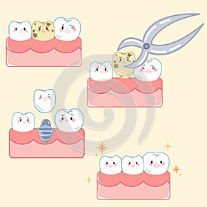 Tooth with implant concept