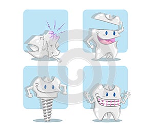 The tooth implant, the crown, the orthodontics and the decay.