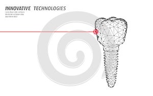 Tooth implant low poly medicine concept. Stomatology innovation technology dental banner template vector illutration