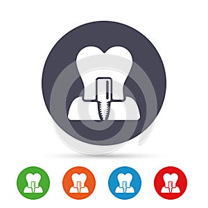 Tooth implant sign icon. Dental care symbol.