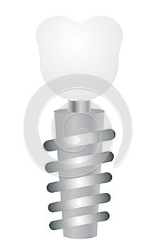 Tooth implant on a white background