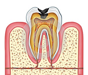 Tooth inner anatomy of a cavity