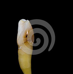 Tooth isolated on black