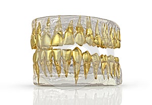 Tooth jaw with gold teeth 3d