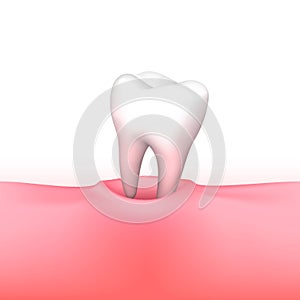 Tooth loss on white background