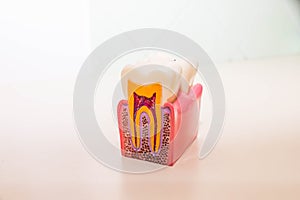 Tooth model without caries, tooth decay in dentist`s office. Healthy teeth concept . children`s dentist. Copy space