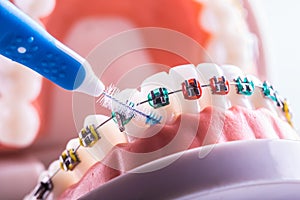 Tooth model from dental braces with inter dental teeth cleaning brush