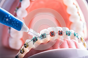 Tooth model from dental braces with inter dental teeth cleaning brush photo