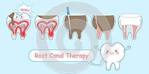 Tooth with root canal therapy