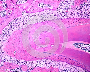 Tooth root. Cellular cementum