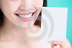 Tooth whiten concept photo