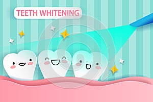 Tooth whitening concept