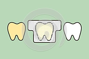 tooth whitening, yellow tooth used teeth whitening strip to whiten - dental cartoon vector flat style