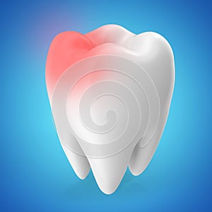 Toothache concept, caries concept isolated on blue tints. 3D rendering