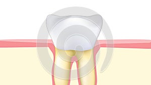 Toothache. pain of the Molar or premolar tooth.