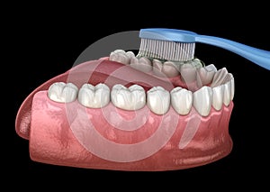 Toothbrush cleaning teeth. Medically accurate illustration of oral hygiene