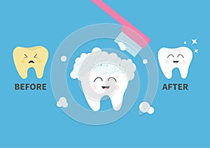 Toothbrush with toothpaste bubble foam. Healthy smiling white tooth icon. Crying bad ill yellow teeth. Before after infographic. C