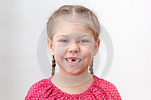 Toothless serious child without upper teeth on white background