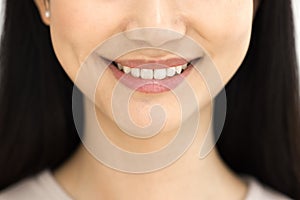 Toothy smile of happy Asian woman showing healthy white teeth