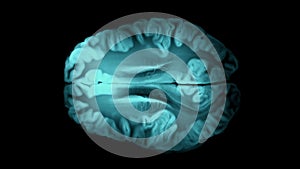 Top view brain with alpha matte. Neurological diseases