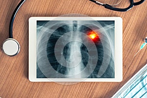 Top view on a digital tablet on a medical desk with x-ray of pain in lung. Stethoscope, syringe and hygienic mask on the desk