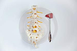 Top view of lumbar spine model and reflex hammer