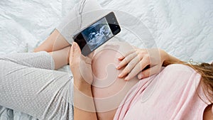 Top view of pregnant woman holding smartphone and looking on ultrasound image of her unborn baby in belly. Concept of