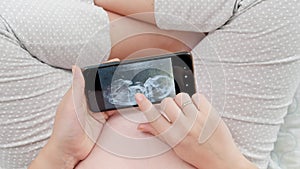 Top view of pregnant woman sitting on bed and looking on ultrasound image of her unborn baby on smartphone