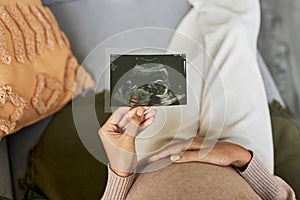 Top view pregnant young woman holding ultrasound picture of baby